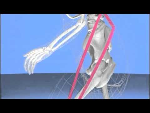 Osteochondrose mit einem Behandlungsgefäßsyndrom Wie ein Bandscheibenvorfall L5-S1 heilen