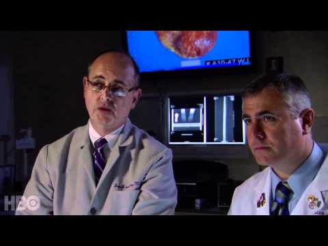 Can Excess Weight Lead to Heart Disease? (HBO: The Weight of the Nation)