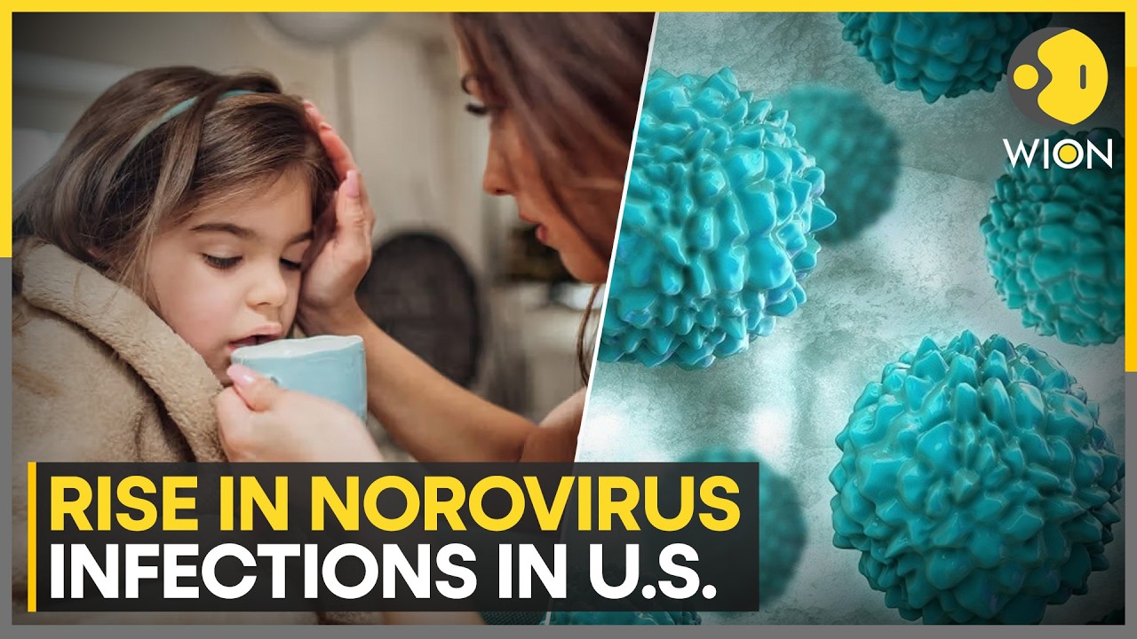 Norovirus Outbreak: Rise In Norovirus Infections Across US Sparks Health Concerns | WION