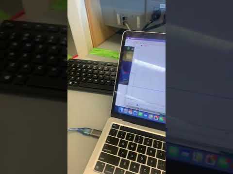 BE 470 Lab 2: Galvanic skin resistance (GSR) sensor