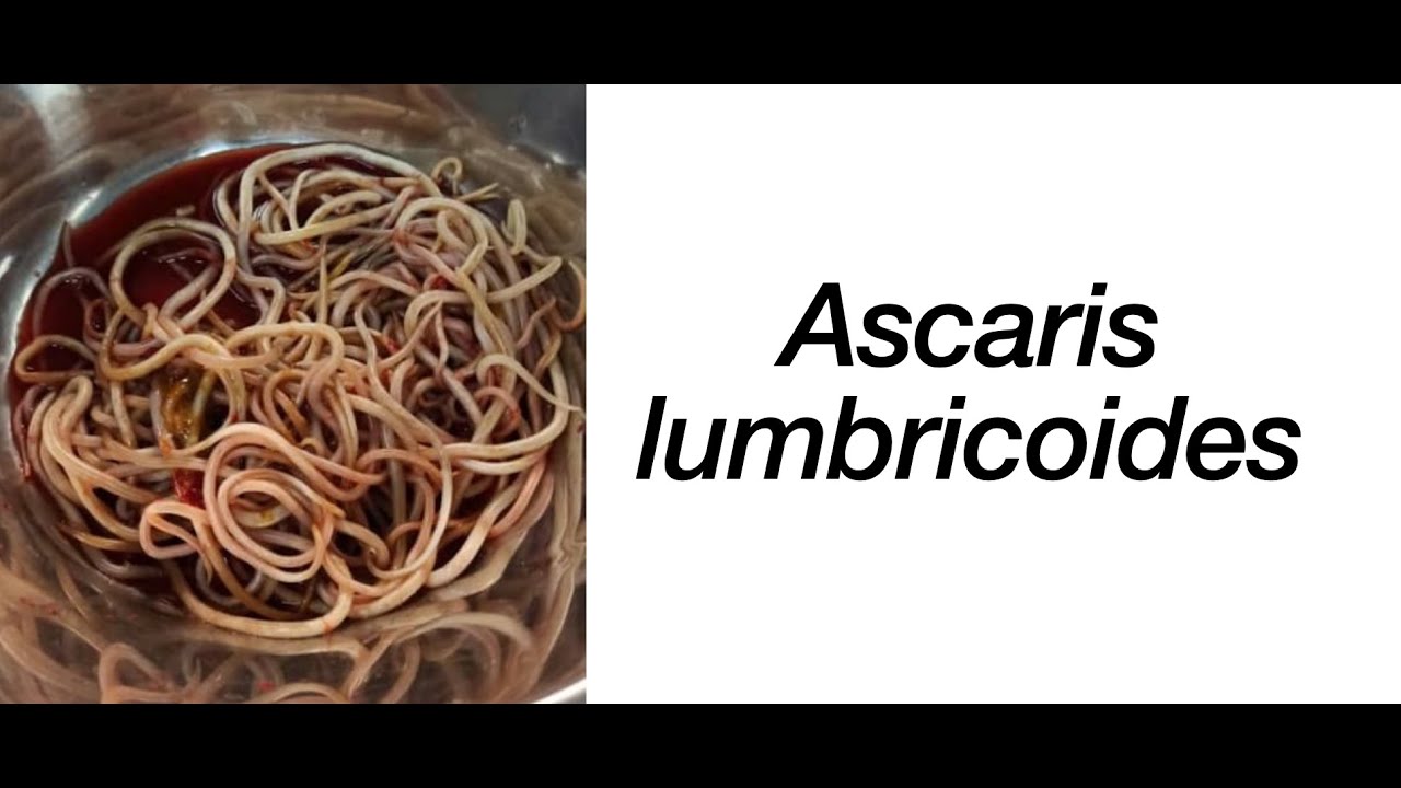 Ascaris lumbricoides: Ciclo de vida, Síntomas y Tratamiento - Parasitosis intestinal