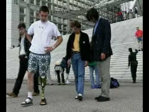 Otto Bock C Leg and C Walk Foot