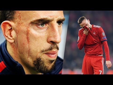 What’s the story of Franck Ribery’s scars?