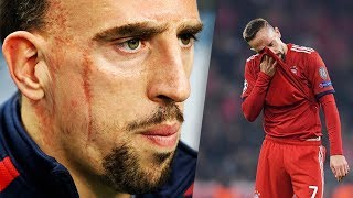 What’s the story of Franck Ribery’s scars