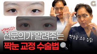 짝눈들 모두 집중! 성형외과 전문의가 알려주는 짝눈 교정 수술법