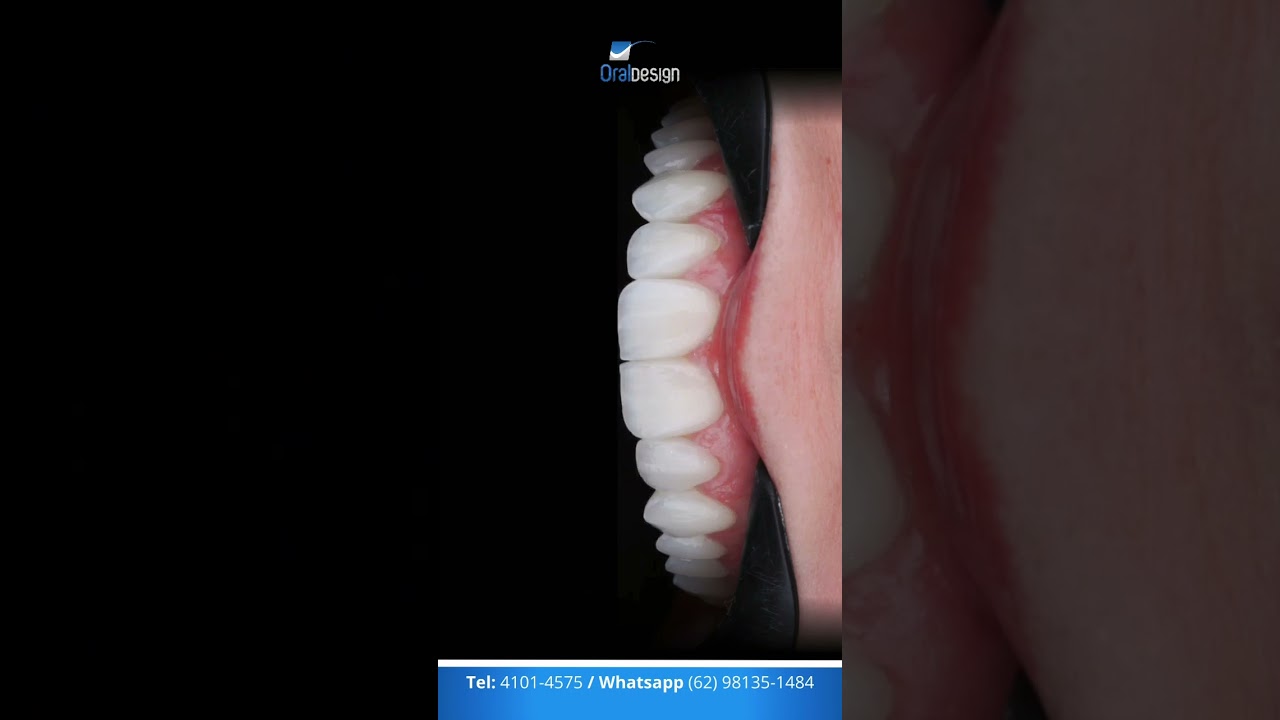 Danilo Monteiro Rezende Pereira-48