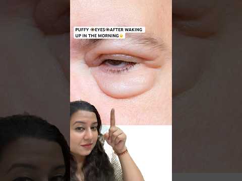 How to PREVENT PUFFY EYES in the morning? #puffyeyes
