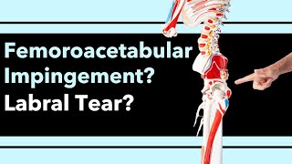 What Is Causing Your Hip Pain, Femoroacetabular Impingement, Labral Tear, How to tell