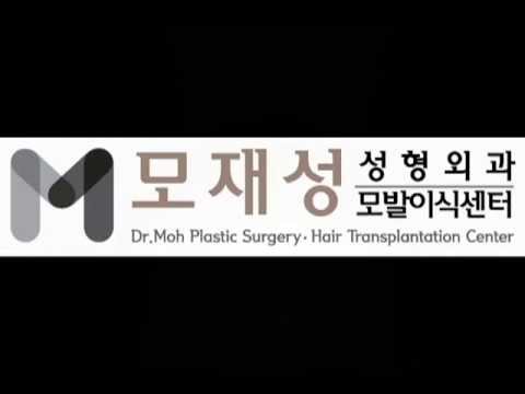 1450FU's. Female Hairline Correction. Hair Transplantation by Dr. Moh