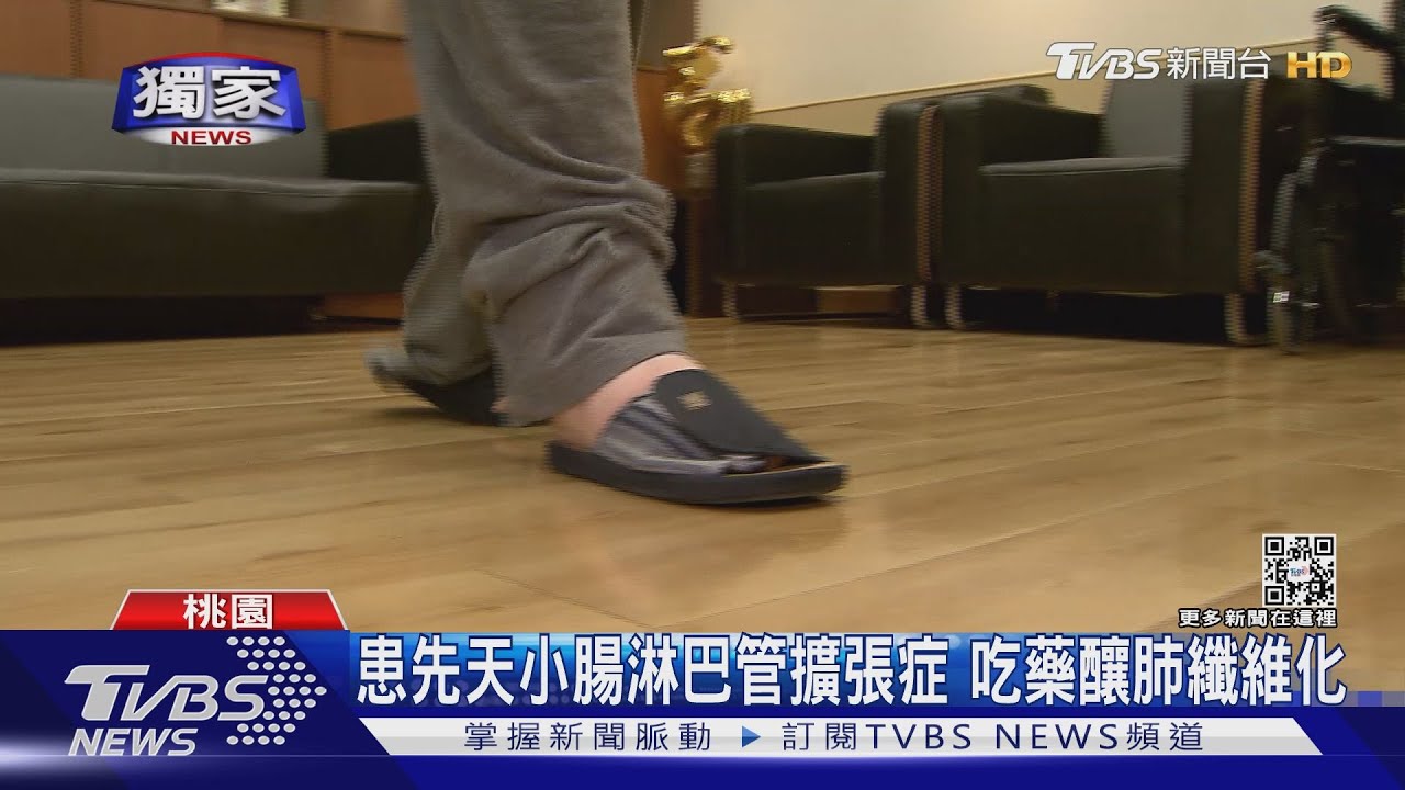 烏克蘭「象腿」女孩來台 開刀治腹、腳部水腫