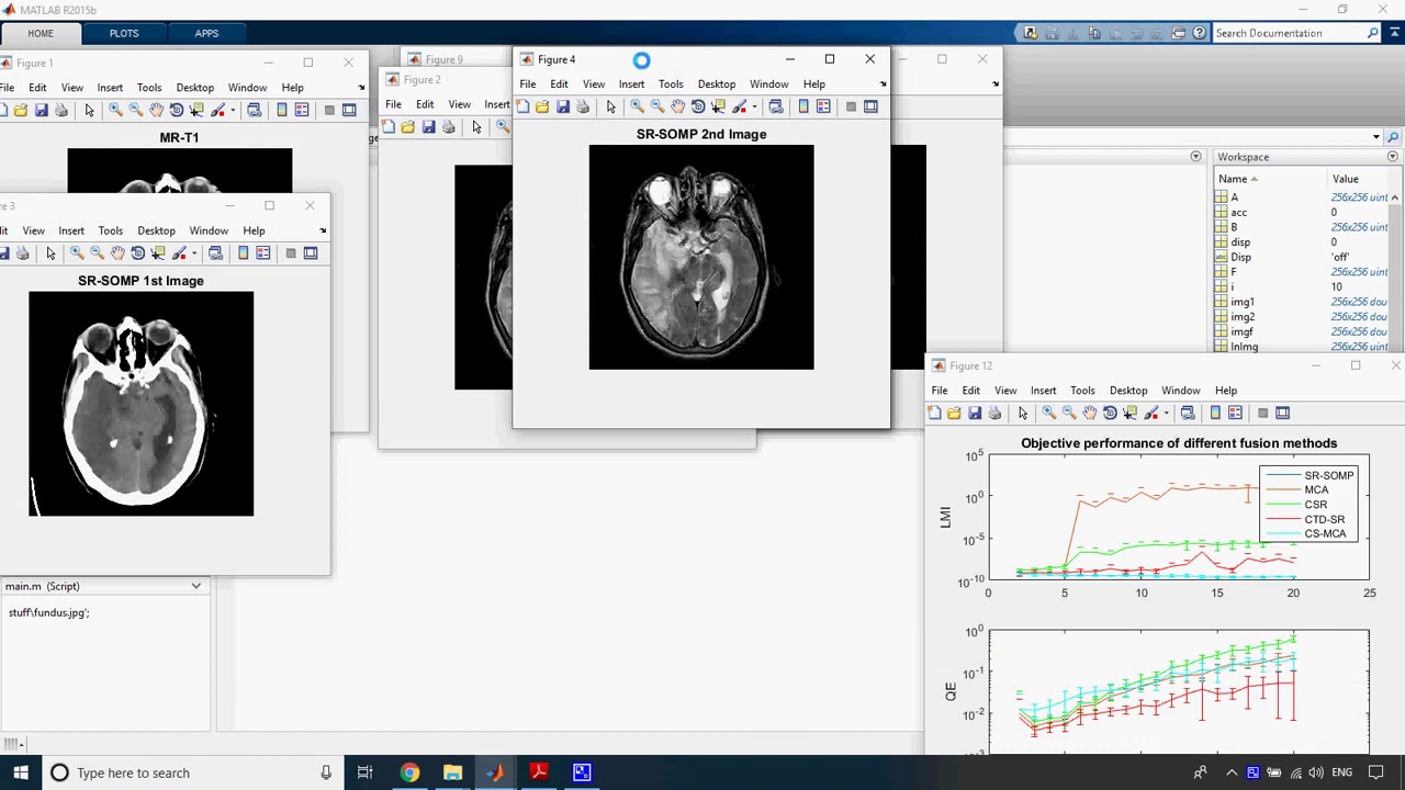 Medical Image Fusion via Convolutional Sparsity Based Morphological ...
