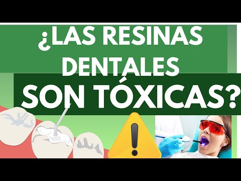 ¿Las resinas dentales son tóxicas?