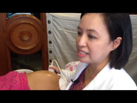 Bahay workouts para sa pagbaba ng timbang lyashek Kung paano mangayayat matapos cesarean nursing ina na walang pinsala sa mga bata