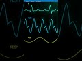 heart rate monitor // free sound effects
