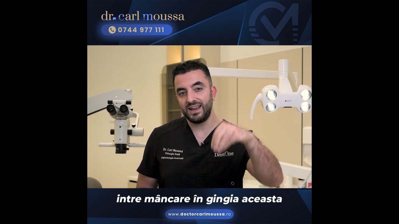 Ce este transplantul de gingie</br> și când este necesar?