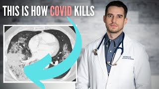 Covid 19 Music Video