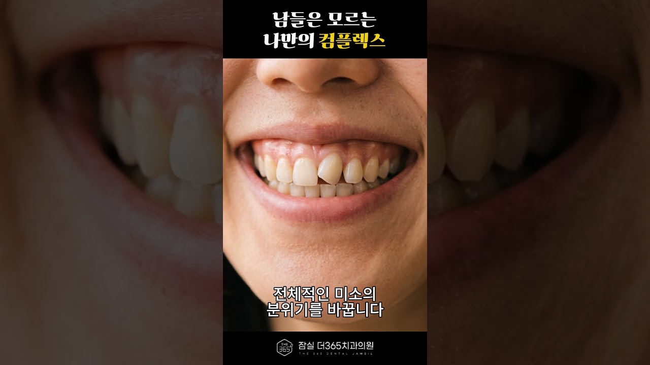 앞니 콤플렉스, 부분교정으로 달라질 수 있습니다😄