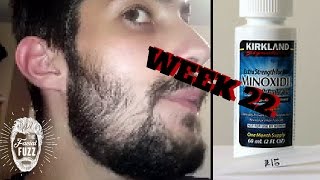 Minoxidil Beard | Week 22 | 5 Months! | The Experiment | #FacialFuzzFridays