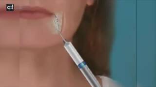 Relleno de líneas de marioneta