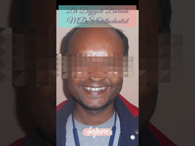 Thumbnail for Post ID: LVNcH5LYW58