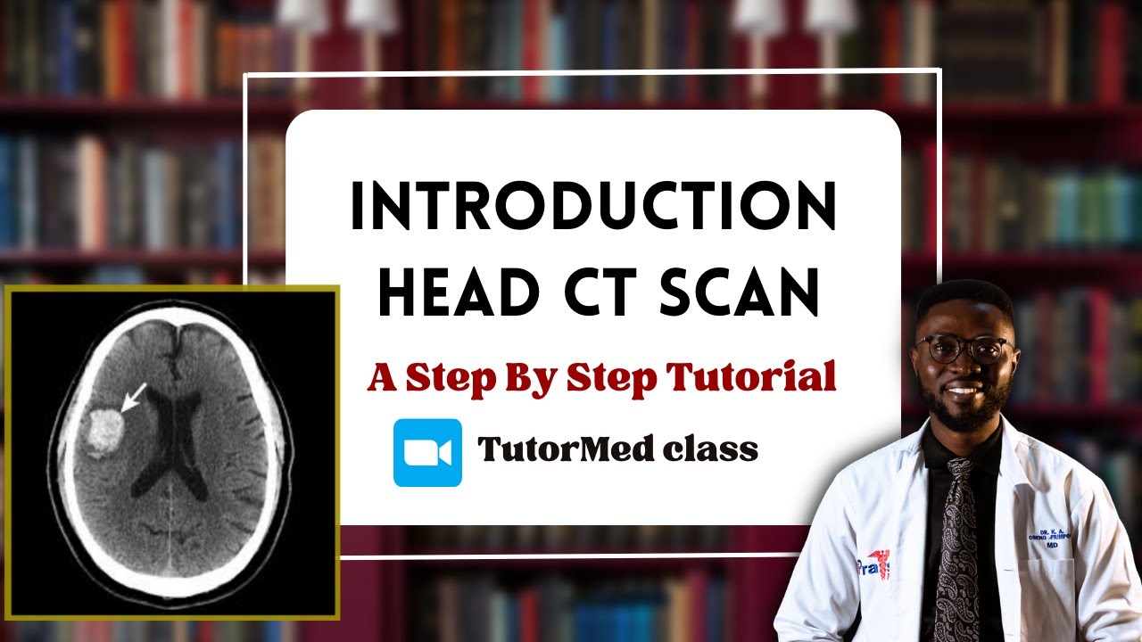 Head CT scan Interpretation Simplified | A Step by Step Tutorial | TutorMed