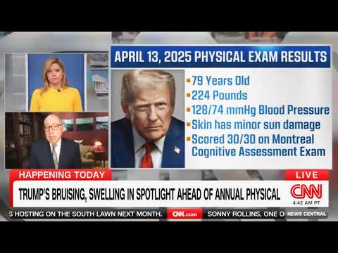 Trump ROCKED by alarming medical assessment