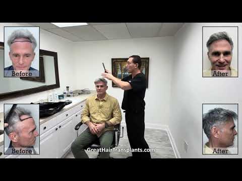 Dr. Brett Bolton MaxHarvest Procedure patient James