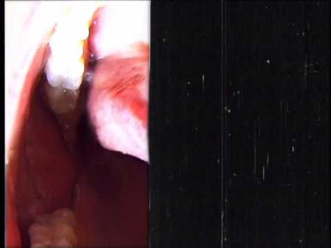Video thumbnail for Debaser (Clif Norrell Mix)