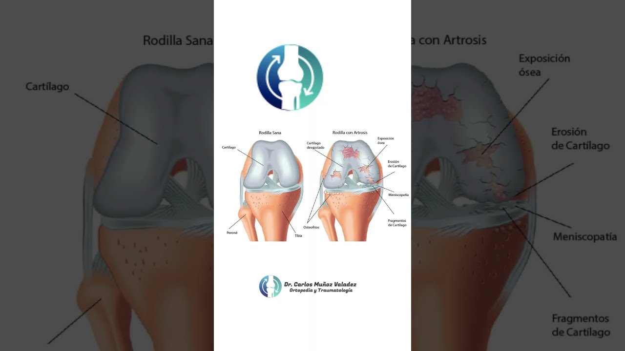 Carlos Ignacio Muñoz Valadez-51