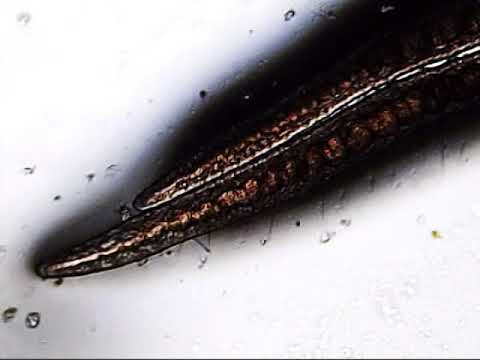 Pinworm lárvák