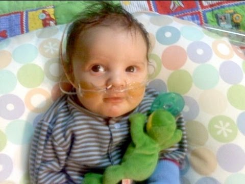 Tell Me a Story: Birth Defect Teaches Parents to Look at Life Differently