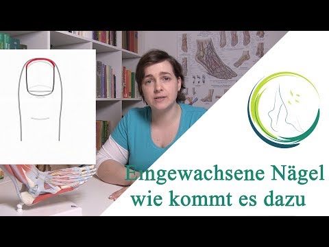 Gribok bei den Kindern die Behandlung von den Volksmitteln Das Foto gribka der Beine auf den Beinen der Haut