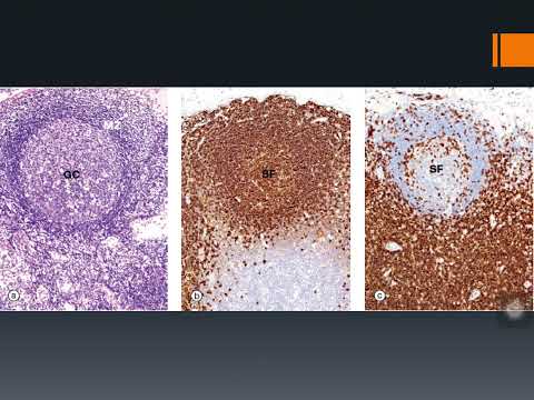 THỰC TẬP MÔ - QUAN SÁT GÌ TRÊN TIÊU BẢN HẠCH LYMPHÔ