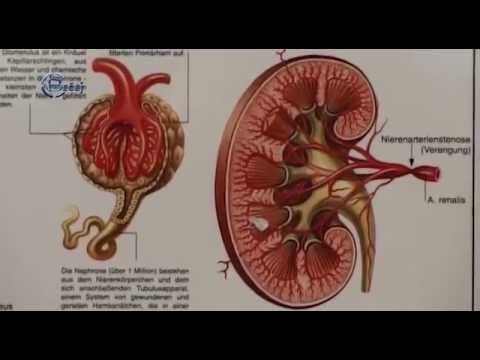 TV BEČEJ: Na novi bubreg čeka se i po nekoliko decenija