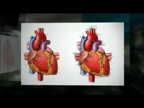 Preview Hospital Dr. Raymi L. De Peña