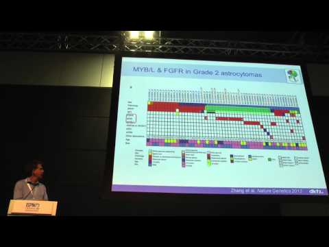 Low Grade Glioma Biology - Dr. Stefan Pfister