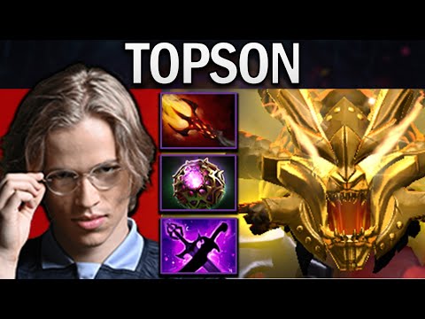 Axe Dota 2 Gameplay Topson with Dagon and Octarine