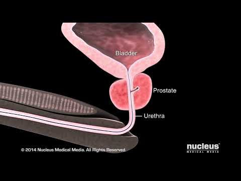 What is Benign Prostatic Hyperplasia (BPH)?