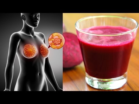 Nehmen die Schmerzen in der Prostata entfernt Chronische Prostatitis vergrößerte Prostata
