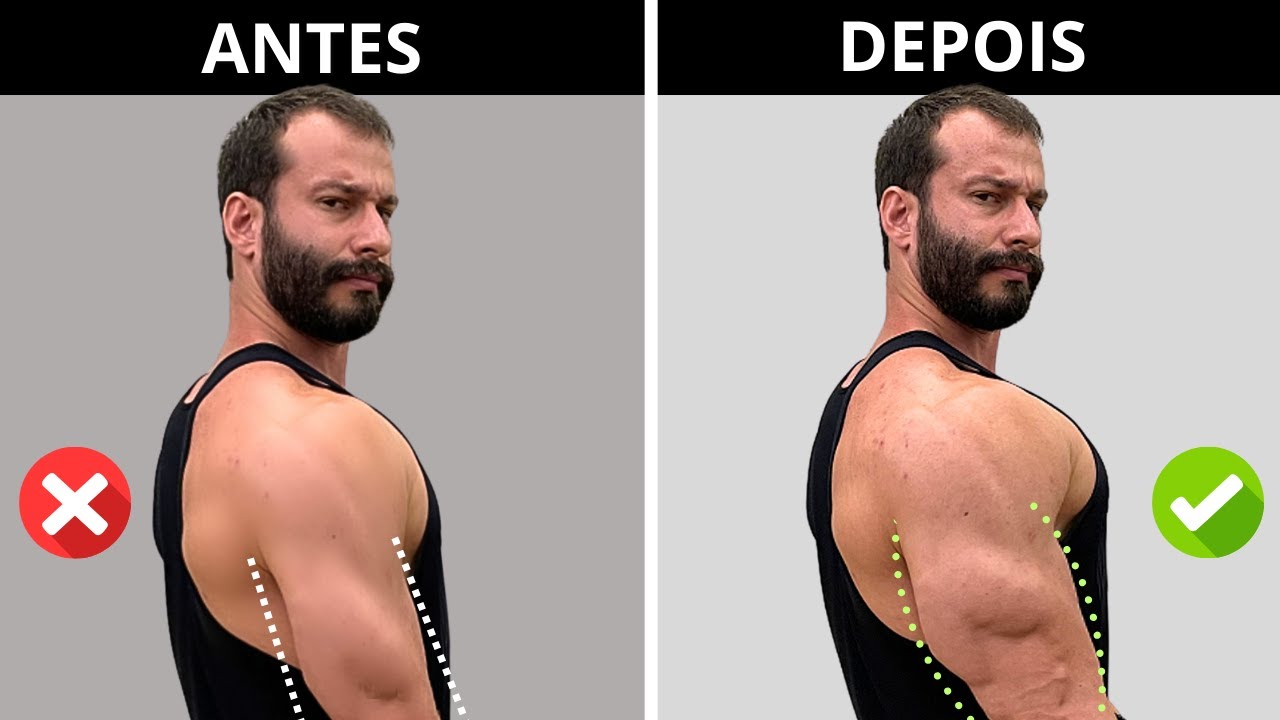 TREINO COMPLETO DE TRÍCEPS: BRAÇO GRANDE E FIBRADO