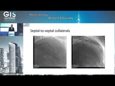 22 Ahmed ElGuindy   Retrograde Approach in CTO