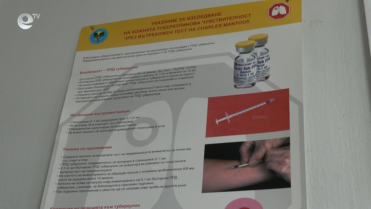 В Смолянската болница тече безплатна скрининг кампания за туберкулоза
