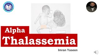 Download Lagu Alpha Thalassemia: Four variants u0026 role of bart hemoglobin| Hematology | by Imran Yaseen Thumbnail