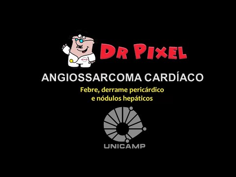 CASE REPORT - Angiossarcoma cardíaco