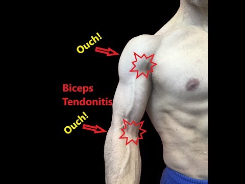 Bicep 2024 tendonitis stretches