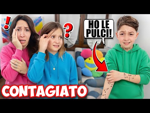 FIGLIODIEGO WAS BITTED ALL OVER HIS BODY BY FLEAS FROM OUR DOG ROCKY, HE'S INFECTING EVERYONE!