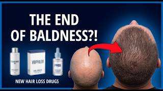 Download lagu 3 New Hair Loss Drugs that could beat Finasteride & Minoxidil mp3