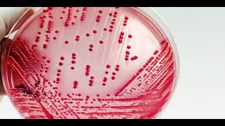 Técnicas de semeadura em microbiologia de alimentos