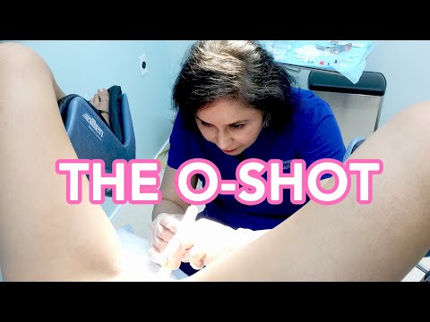 (GRAPHIC) The O-Shot Procedure in San Francisco | Dr. Usha Rajagopal