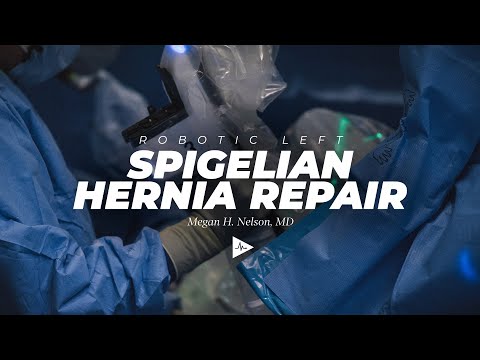 Robot Assisted Ventral Hernia Repair (Spigelian) | Preview